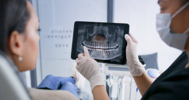 Licensed Wisdom Tooth Removal service in Parma, OH - Smile Center Dentistry